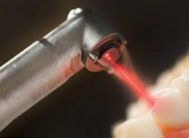 Laserul dentar